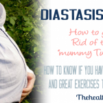 How to Know if You Have Diastasis Recti and What to Do About It