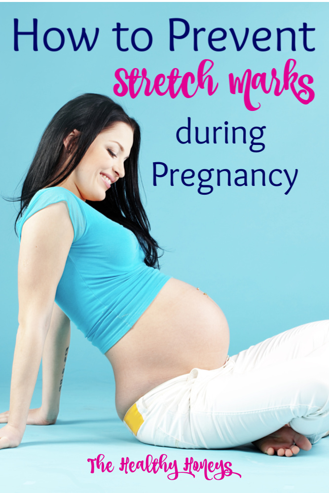 prevent stretch marks